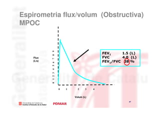 Espirometria flux/volum (Obstructiva)
MPOC



            7 8 9                             FEV1    1.5 (L)
    Flux                                      FVC     4.0 (L)
    (L/s)                                     FEV1/FVC 38 %
            4 5 6
            0 1 2 3




                      0   1     2     3   4


                              Volum (L)
                                                         47
                                                                47
 