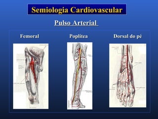 Semiologia CardiovascularSemiologia Cardiovascular
Pulso ArterialPulso Arterial
Femoral PoplíteaFemoral Poplítea Dorsal do péDorsal do pé
 
