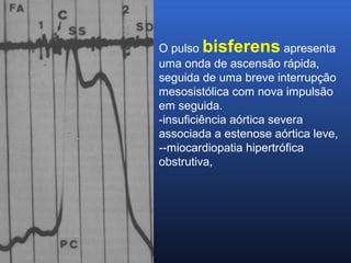 O pulso bisferens apresenta
uma onda de ascensão rápida,
seguida de uma breve interrupção
mesosistólica com nova impulsão
em seguida.
-insuficiência aórtica severa
associada a estenose aórtica leve,
--miocardiopatia hipertrófica
obstrutiva,
 