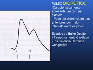 PULSO DICRÓTICO
-Caracteristicamente
apresenta um pico na
diástole.
- Pode ser diferenciado dos
anteriores por maior
intervalo entre os picos.
Estados de Baixo Débito
- Tamponamento Cardíaco
- Insuficiência Cardíaca
Congestiva
 