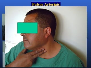 Pulsos ArteriaisPulsos Arteriais
PoplíteoPoplíteo
RadialRadial
PediosoPedioso
MaleolarMaleolar
 