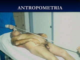 ANTROPOMETRIA 