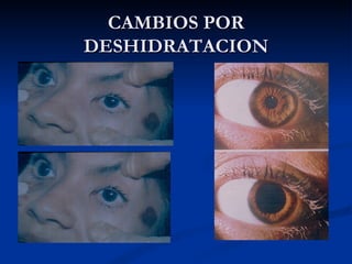 CAMBIOS POR DESHIDRATACION 