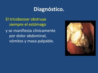 Diagnóstico.
El tricobezoar obstruye
siempre el estómago
y se manifiesta clínicamente
por dolor abdominal,
vómitos y masa palpable.