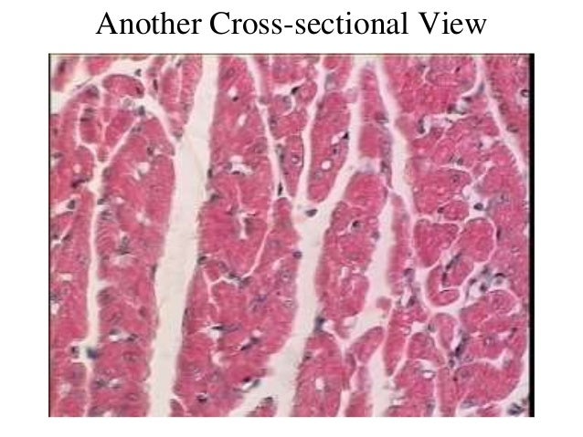 pix Cardiac Muscle Histology Cross Section 3 cardiac muscle tissue