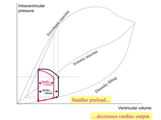 Intraventricular
pressure
Ventricular volume
Stroke
volume
Stroke
volume
Smaller preload...
…decreases cardiac output.
 