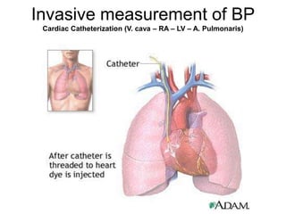 Invasive measurement of BP
Cardiac Catheterization (V. cava – RA – LV – A. Pulmonaris)
 