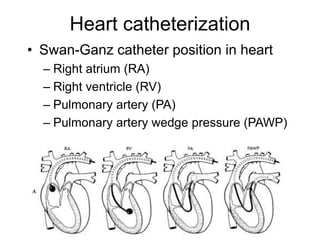 Heart catheterization
• Swan-Ganz catheter position in heart
– Right atrium (RA)
– Right ventricle (RV)
– Pulmonary artery (PA)
– Pulmonary artery wedge pressure (PAWP)
 