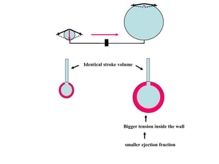Identical stroke volume
Bigger tension inside the wall
smaller ejection fraction
 