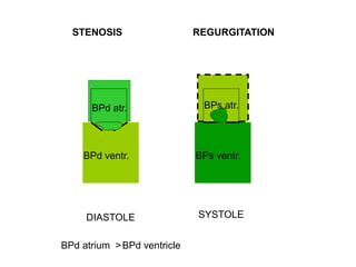 DIASTOLE SYSTOLE
BPd atr.
BPd ventr.
BPs atr.
BPs ventr.
STENOSIS REGURGITATION
BPd atrium >BPd ventricle
 