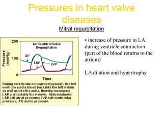 Pressures in heart valve
diseases
Mitral regurgitation
• increase of pressure in LA
during ventricle contraction
(part of the blood returns to the
atrium)
LA dilation and hypertrophy
 