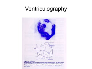 Ventriculography
 