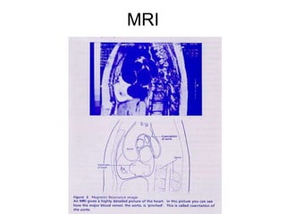 MRI
 