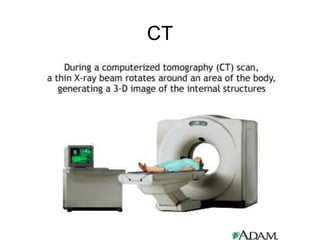 CT
 