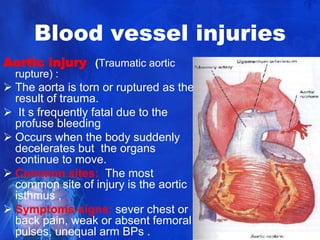 3 -Chest_injuries.pptx