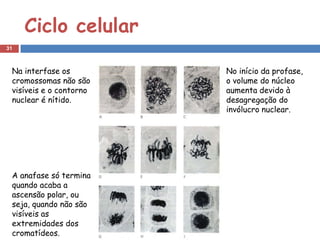 Ciclo celular
31



 Na interfase os         No início da profase,
 cromossomas não são     o volume do núcleo
 visíveis e o contorno   aumenta devido à
 nuclear é nítido.       desagregação do
                         invólucro nuclear.




 A anafase só termina
 quando acaba a
 ascensão polar, ou
 seja, quando não são
 visíveis as
 extremidades dos
 cromatídeos.
 