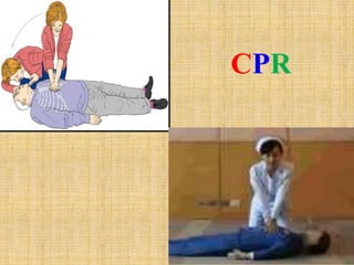 3-CPR.pptx
