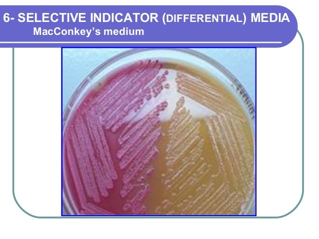 selective differential media Blood agar is one type of differential medium some differential media are also selective, ie, most of the standard enteric agars such as macconkey and emb. selective differential media Blood agar is one type of differential medium some differential media are also selective, ie, most of the standard enteric agars such as macconkey and emb.
