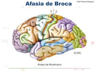 Afasia de Broca
Profª Viviane Marques
 