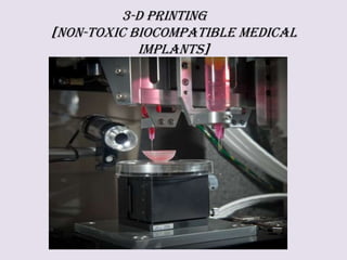 3-D Printing
[Non-toxic biocompatible medical
implants]
 