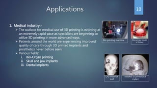 Applications 10
1. Medical industry:-
 The outlook for medical use of 3D printing is evolving at
an extremely rapid pace as specialists are beginning to
utilize 3D printing in more advanced ways.
 Patients around the world are experiencing improved
quality of care through 3D printed implants and
prosthetics never before seen.
 Various fields:
i. Bio-Organ printing
ii. Skull and jaw implants
iii. Dental implants
CAD model of
skull
Bio printing machine Bio-printed model
of Kidney
Installed 3D printed skull
implant
 