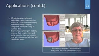 Applications (contd.) 11
 3D printing as an advanced
technology can compensate the
individual’s disability or deficiency
by manufacturing complex
composite 3D objects using 3D
scanned data.
 It can help people regain mobility,
improve their employment and
social opportunities and possibly
help self-reliance and alleviate self-
confidence issues.
Scanned and designed CAD model (left),
Integration due to 3D printed part (right)
 