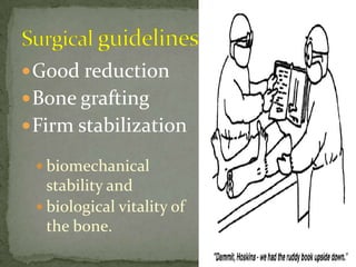 The fragments are mobilized, preserving their normal soft-tissue attachments as much as possible.Extensive dissection is avoided, resecting only the scar tissue and the rounded ends of the bones so that contact is maximalMedullary canals are cleared of fibrous tissue to aid in medullaryosteogenesis and they are apposed ReductionofFragments