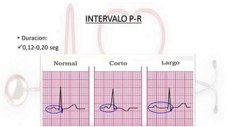 INTERVALO P-R
• Duracion:
0,12-0,20 seg
 