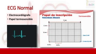 ECG Normal
• Electrocardiógrafo
• Papel termosensible
 