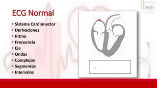 ECG Normal
• Sistema Cardionector
• Derivaciones
• Ritmo
• Frecuencia
• Eje
• Ondas
• Complejos
• Segmentos
• Intervalos
 