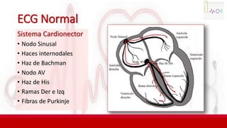 ECG Normal
Sistema Cardionector
• Nodo Sinusal
• Haces internodales
• Haz de Bachman
• Nodo AV
• Haz de His
• Ramas Der e Izq
• Fibras de Purkinje
 