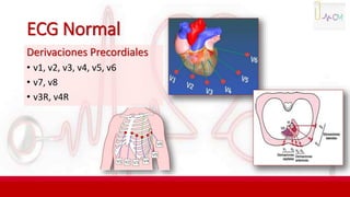ECG Normal
Derivaciones Precordiales
• v1, v2, v3, v4, v5, v6
• v7, v8
• v3R, v4R
 