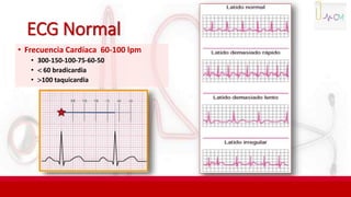 ECG Normal
• Frecuencia Cardíaca 60-100 lpm
• 300-150-100-75-60-50
•  60 bradicardia
• 100 taquicardia
 