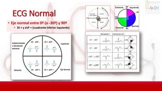 ECG Normal
• Eje normal entre 0º (o -30º) y 90º
• DI + y aVF + (cuadrante inferior izquierdo)
 