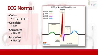 ECG Normal
• Ondas
• P – Q – R – S – T
• Complejos
• QRS
• Segmentos
• PR – ST
• Intervalos
• PR – QT
 