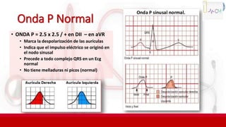 Onda P Normal
• ONDA P = 2.5 x 2.5 / + en DII – en aVR
• Marca la despolarización de las aurículas
• Indica que el impulso eléctrico se originó en
el nodo sinusal
• Precede a todo complejo QRS en un Ecg
normal
• No tiene melladuras ni picos (normal)
 