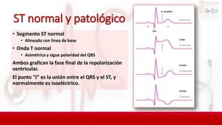 ST normal y patológico
• Segmento ST normal
• Alineado con línea de base
• Onda T normal
• Asimétrica y sigue polaridad del QRS
Ambos grafican la fase final de la repolarización
ventricular.
El punto “J” es la unión entre el QRS y el ST, y
normalmente es isoeléctrico.
 