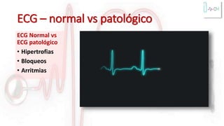 ECG – normal vs patológico
ECG Normal vs
ECG patológico
• Hipertrofias
• Bloqueos
• Arritmias
 