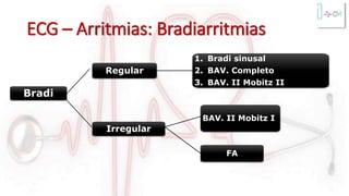 ECG – Arritmias: Bradiarritmias
Bradi
Regular
Irregular
BAV. II Mobitz I
FA
1. Bradi sinusal
2. BAV. Completo
3. BAV. II Mobitz II
 
