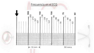 Frecuencia en el ECG
 