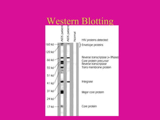 Western Blotting
 