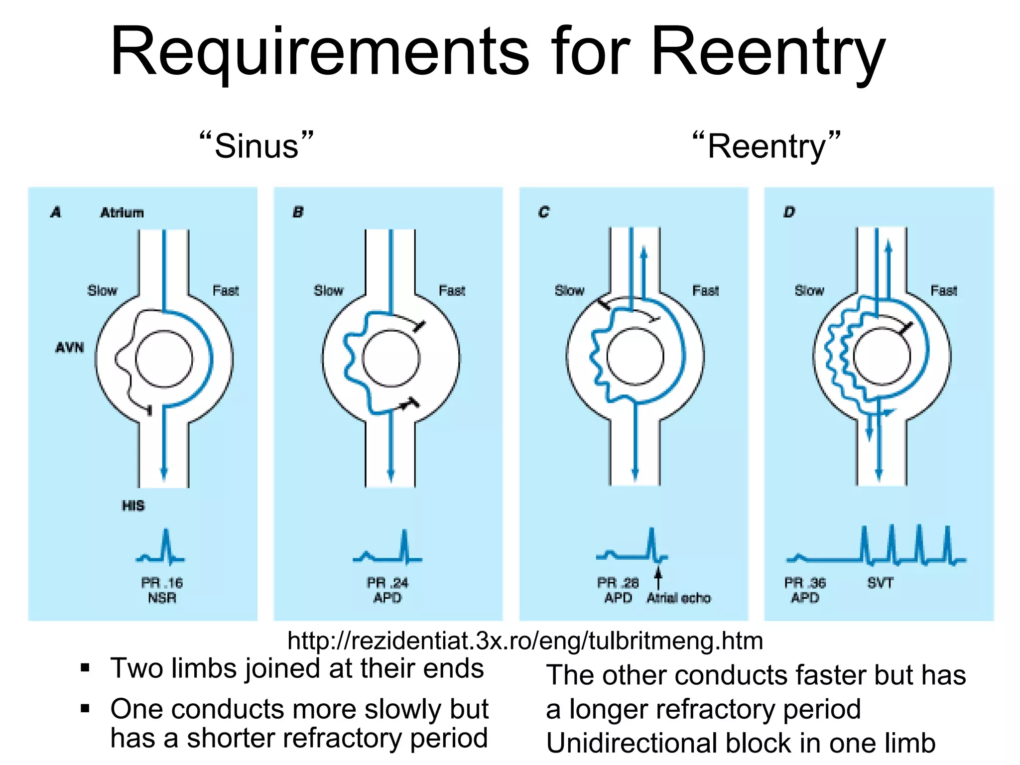 Requirements for Reentry
             “Sinus”                                     “Reentry”




                    http://rezidentiat.3x.ro/eng/tulbritmeng.htm
     Two limbs joined at their ends       The other conducts faster but has
     One conducts more slowly but         a longer refractory period
107
      has a shorter refractory period      Unidirectional block in one limb
 