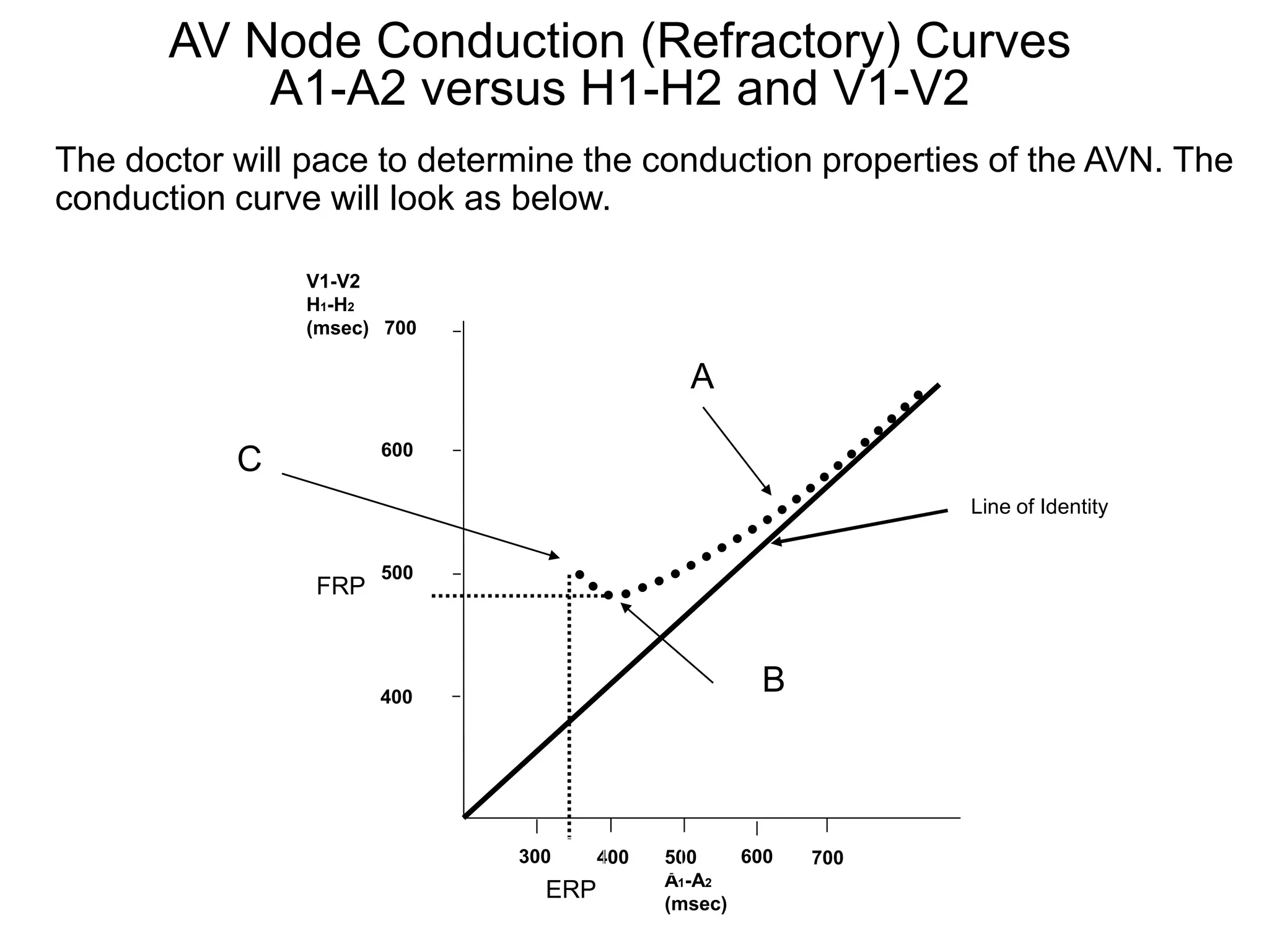 AV Node Conduction (Refractory) Curves
           A1-A2 versus H1-H2 and V1-V2
The doctor will pace to determine the conduction properties of the AVN. The
conduction curve will look as below.

               V1-V2
               H1-H2
               (msec) 700

                                             A
                      600
           C
                                                              Line of Identity


                      500
                FRP



                      400
                                                   B



                             300     400   500    600   700
                                           A1-A2
                               ERP         (msec)
17
 