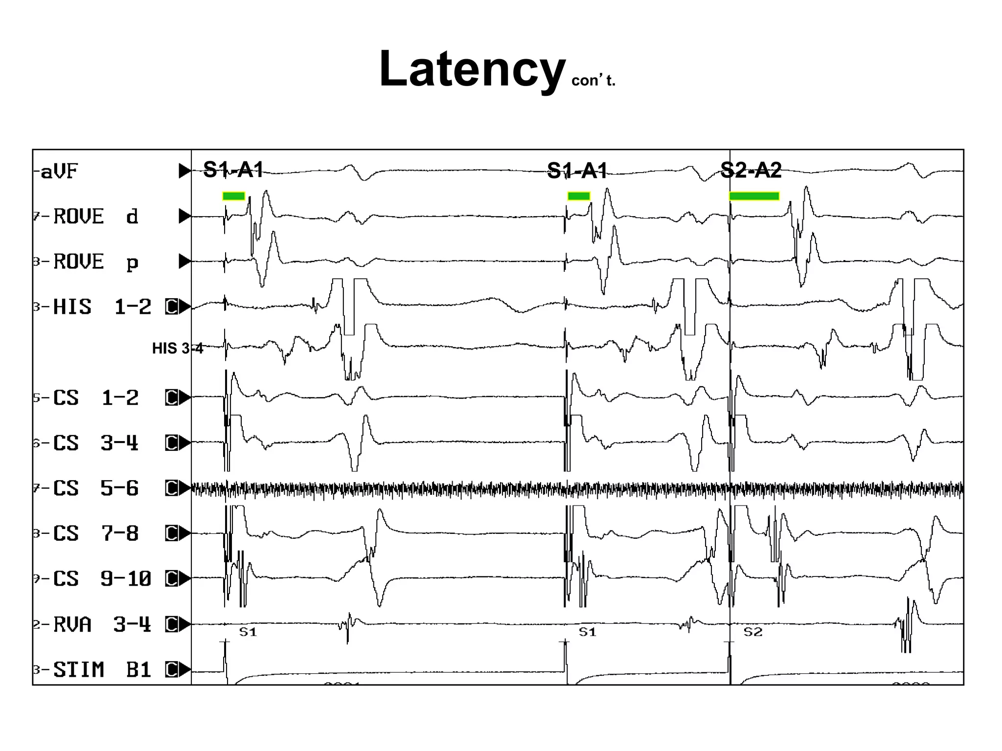 Latency   con’t.




           S1-A1         S1-A1        S2-A2




     HIS 3-4




38
 