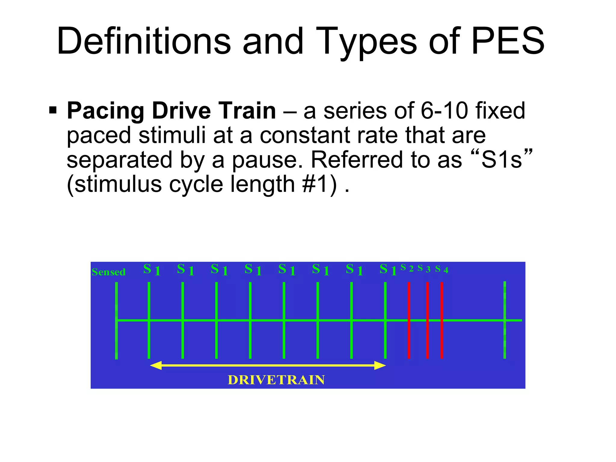 Definitions and Types of PES
     Pacing Drive Train – a series of 6-10 fixed
      paced stimuli at a constant rate that are
      separated by a pause. Referred to as “S1s”
      (stimulus cycle length #1) .


        Sensed   S1   S1   S1   S1   S1   S1   S1   S1S2 S3   S4




                            DRIVETRAIN



5
 