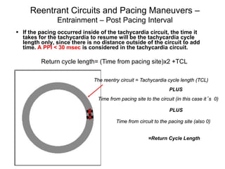 Reentrant Circuits and Pacing Maneuvers –
                     Entrainment – Post Pacing Interval
       If the pacing occurred inside of the tachycardia circuit, the time it
        takes for the tachycardia to resume will be the tachycardia cycle
        length only, since there is no distance outside of the circuit to add
        time. A PPI < 30 msec is considered in the tachycardia circuit.

               Return cycle length= (Time from pacing site)x2 +TCL

                                    The reentry circuit = Tachycardia cycle length (TCL)
                                                                       PLUS
                                     Time from pacing site to the circuit (in this case it’s 0)

                                                                       PLUS

                                              Time from circuit to the pacing site (also 0)


                                                             =Return Cycle Length



118
 