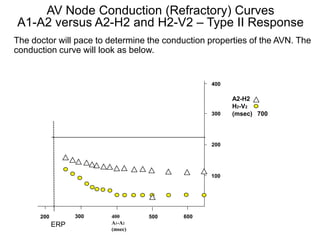 AV Node Conduction (Refractory) Curves
 A1-A2 versus A2-H2 and H2-V2 – Type II Response
The doctor will pace to determine the conduction properties of the AVN. The
conduction curve will look as below.


                                                 400

                                                       A2-H2
                                                       H2-V2
                                                 300   (msec) 700



                                                 200




                                                 100




      200         300   400       500     600
            ERP         A1-A2
20                      (msec)
 