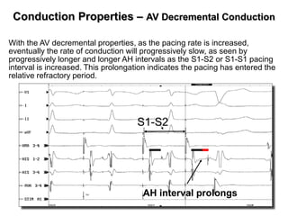 Conduction Properties – AV Decremental Conduction

With the AV decremental properties, as the pacing rate is increased,
eventually the rate of conduction will progressively slow, as seen by
progressively longer and longer AH intervals as the S1-S2 or S1-S1 pacing
interval is increased. This prolongation indicates the pacing has entered the
relative refractory period.




                                     S1-S2




                                      AH interval prolongs
 23
 