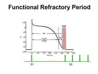 Functional Refractory Period

                       FRP




            S1               S2

43
 