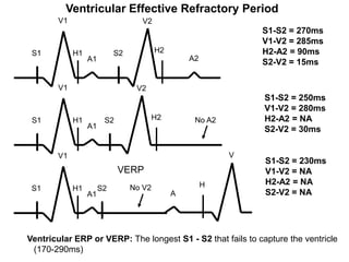 Ventricular Effective Refractory Period
             V1                         V2
                                                                    S1-S2 = 270ms
                                                                    V1-V2 = 285ms
      S1          H1             S2           H2                    H2-A2 = 90ms
                       A1                              A2
                                                                    S2-V2 = 15ms

             V1                        V2
                                                                    S1-S2 = 250ms
                                                                    V1-V2 = 280ms
      S1          H1         S2             H2          No A2       H2-A2 = NA
                       A1                                           S2-V2 = 30ms


            V1                                                  V
                                                                    S1-S2 = 230ms
                                  VERP                              V1-V2 = NA
                                                            H       H2-A2 = NA
      S1          H1        S2        No V2
                       A1                          A                S2-V2 = NA




     Ventricular ERP or VERP: The longest S1 - S2 that fails to capture the ventricle
62    (170-290ms)
 